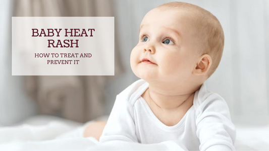 BABY HEAT RASH: HOW TO TREAT AND PREVENT IT