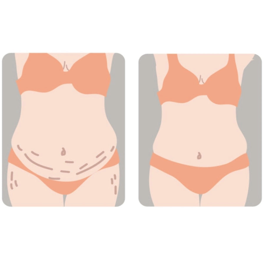Sunveno - Breathable Postpartum Abdominal Belt (White)