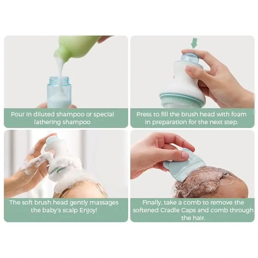Momcozy Innovative Baby Cradle Cap Brush