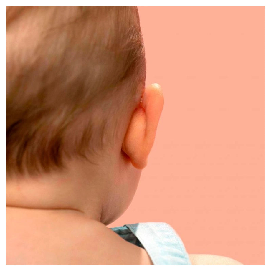 Otostick Baby Ear Correctors (8 Count with Cap)