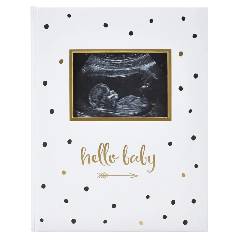 Pearhead Sonogram Babybook Sono