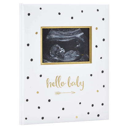 Pearhead Sonogram Babybook Sono